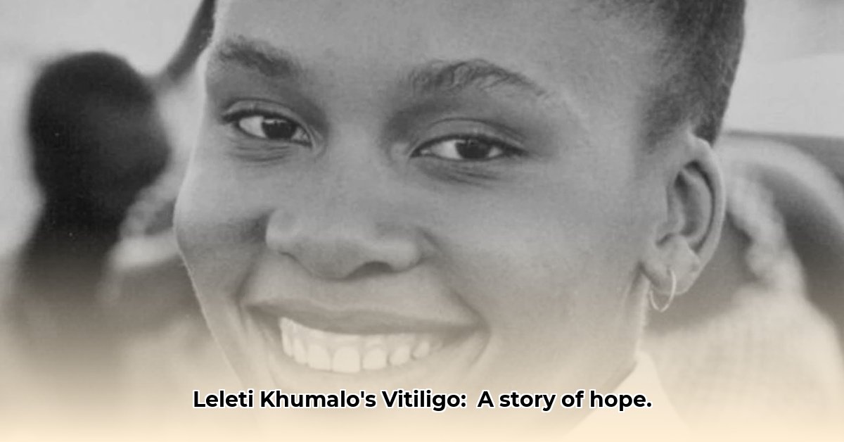 leleti-khumalo-skin-condition